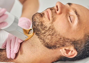 Man receiving a Laser Hair Removal Treatment on Neck