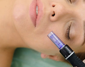Microneedling